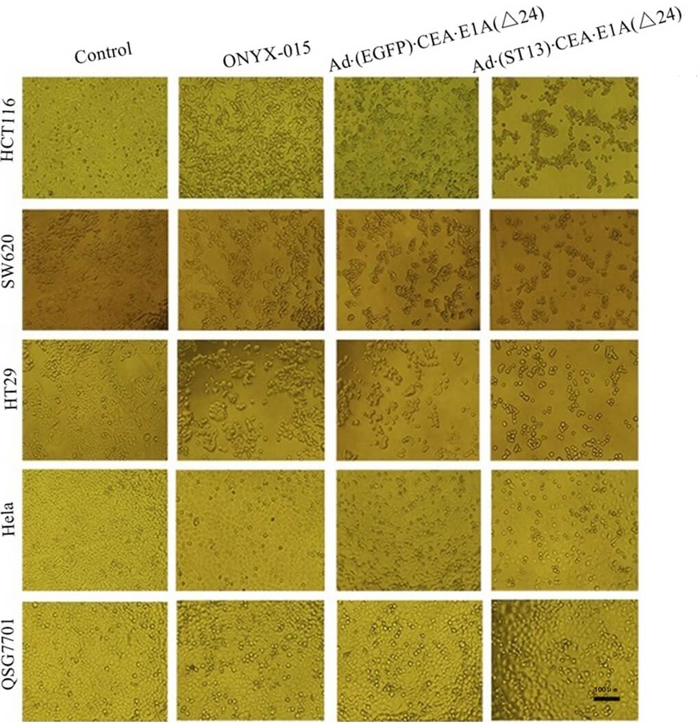 The morphological changes of tumor cells and normal cells infected with different oncolytic adenoviruses were observed by microscope. (OA Literature)