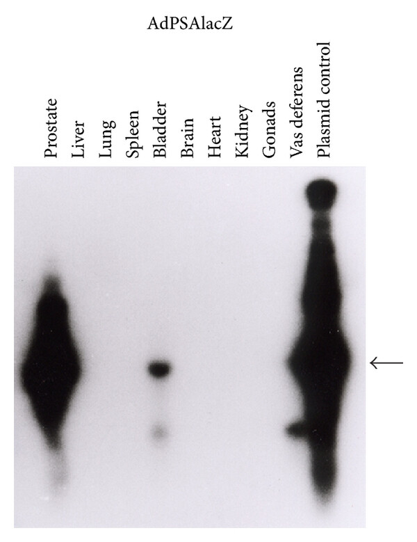 DNA was extracted from various canine tissues, and PCR Southern blot analysis of adenovirus sequences was performed using PCR primers flanking the 860 bp sequence of the adenovirus genome. (OA Literature)