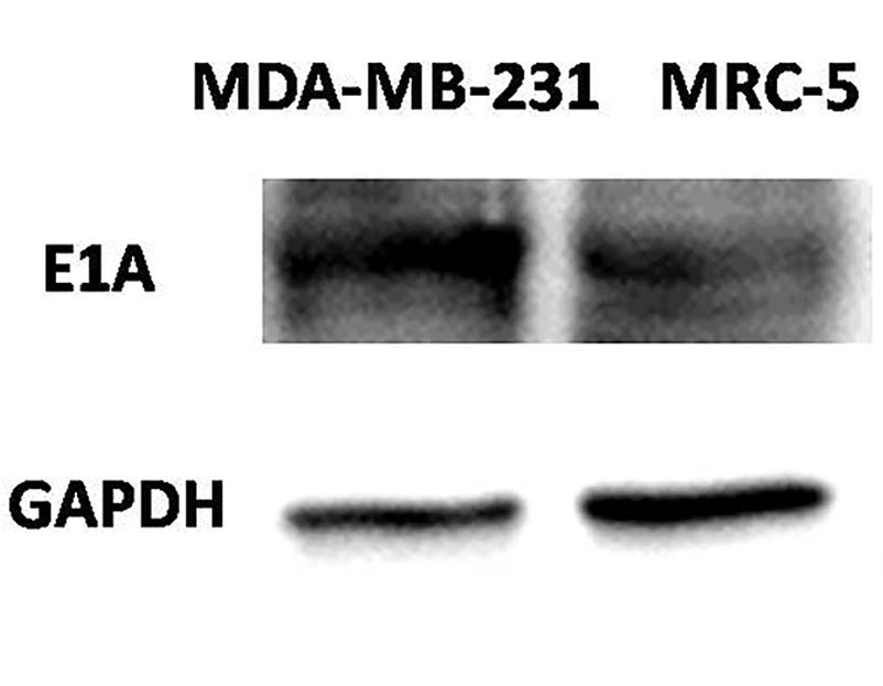 E1A protein expression of E2F promoter-driven oncolytic adenovirus in tumor cells. (OA Literature)