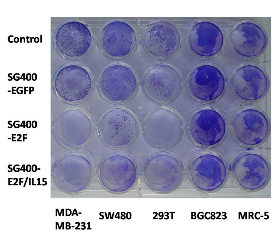 The cytotoxic effect of oncolytic virus on tumor cells could be observed by crystal violet staining. (OA Literature)