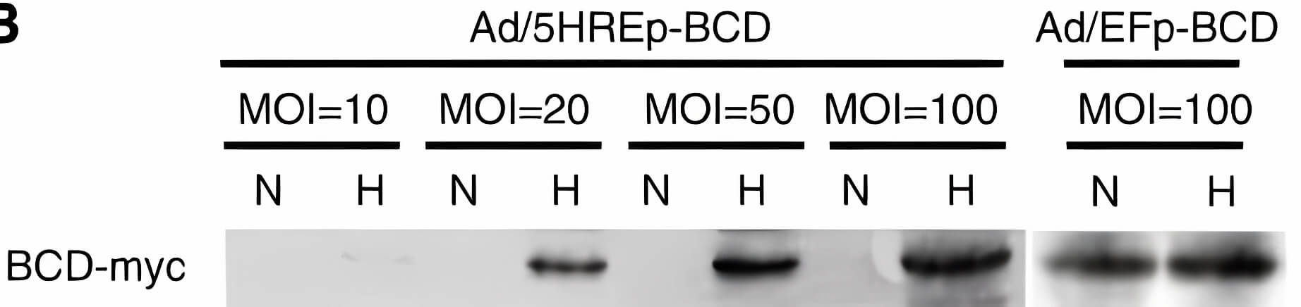 Western blot analysis of BCD-myc expression in tumor cells under normoxic (N) or hypoxic (H) conditions. (OA Literature)
