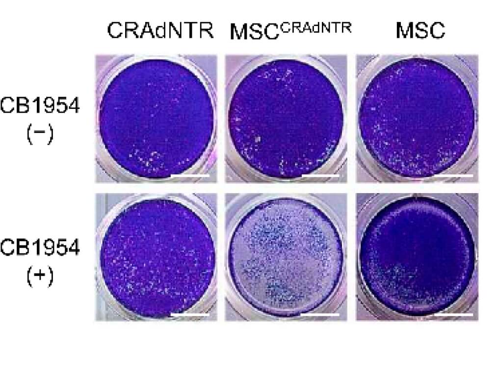 The toxicity of oncolytic adenovirus loaded with prodrug to tumor cells was detected by crystal violet staining (OA Literature)