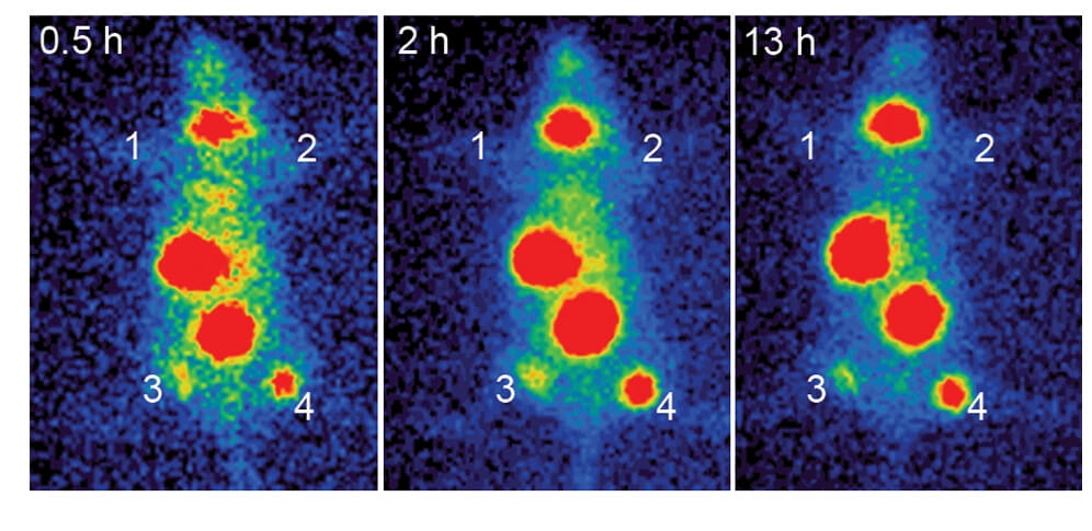 Tumor uptake at 0.5 h, 2 h, and 13 h after IV 123I administration. Tumors were injected with hTERT virus twice, 24 h and 48 h before the injection of radioiodine. (OA Literature)