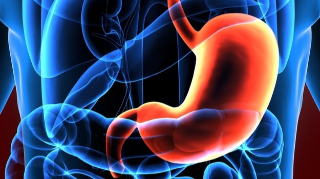 Gastric cancer. (Creative Biolabs Authorized)