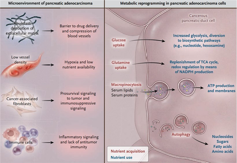 Biologic features of pancreatic cancer.