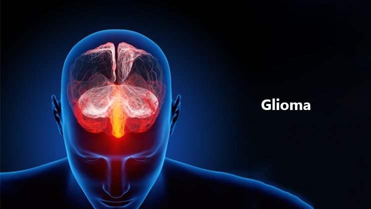 Oncolytic Viruses in Glioma Treatment