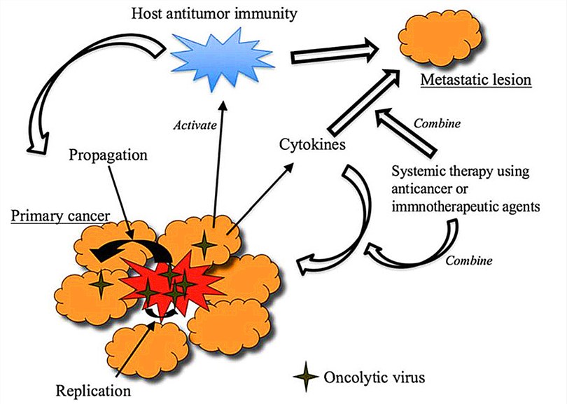 Mechanisms of action of oncolytic virus therapy. 