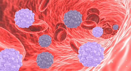 Oncolytic Virotherapy Development for Hematologic Malignancies