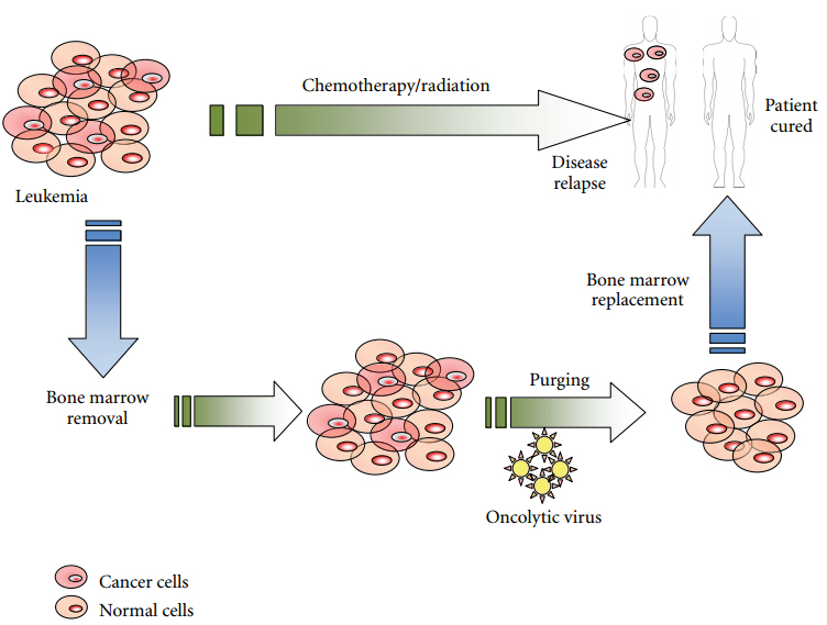 Oncolytic Virotherapy Development for Hematologic Malignancies