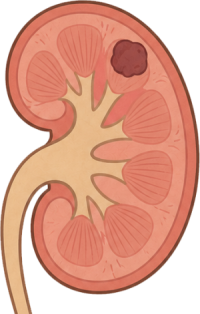 Genitourinary Malignancies