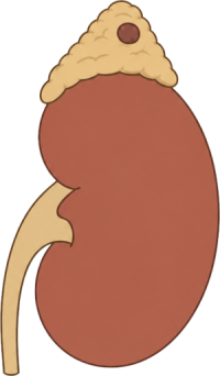 Pediatric Cancer (Neuroblastoma)