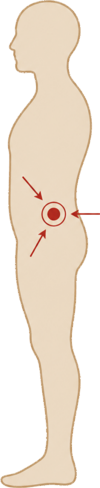 Route and tumor site compatibility