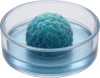 3D tumor spheroid