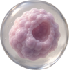 Tumor organoid