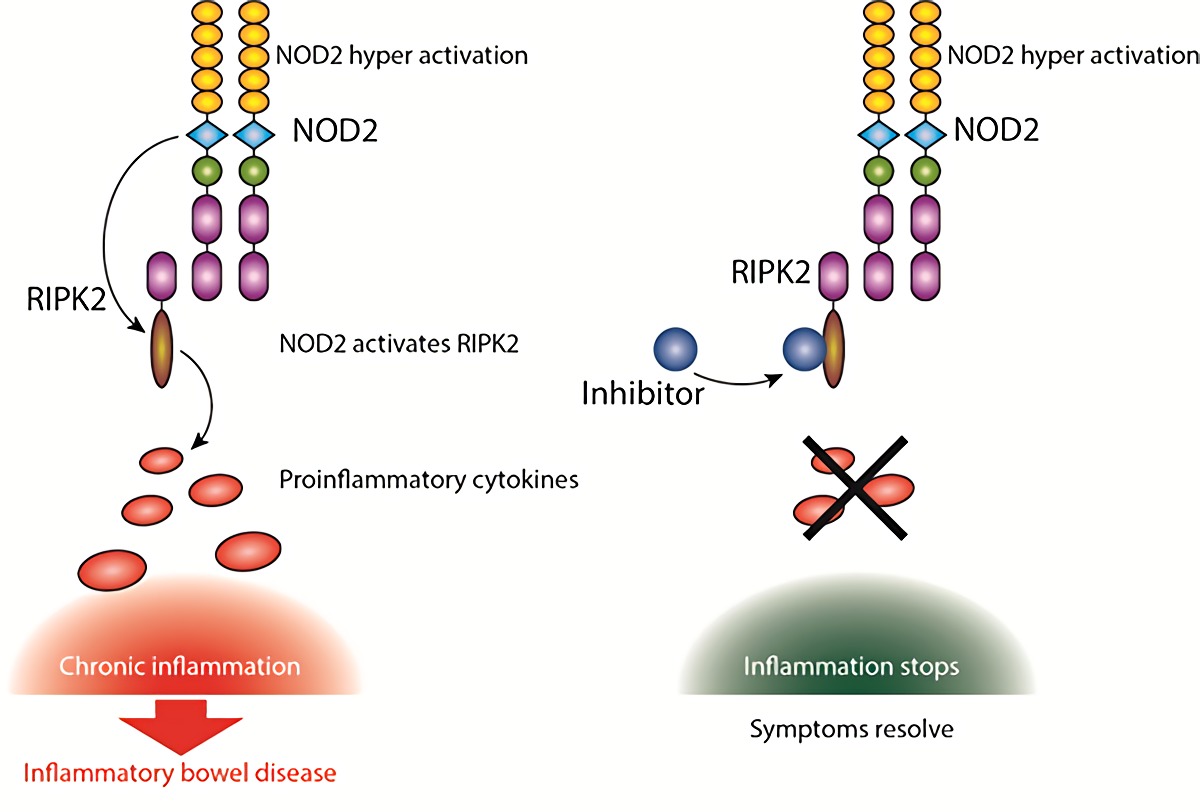 Intercepting inflammation with RIPK2 inhibitors.