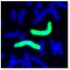 Human chromosome 1 painting probe (green)