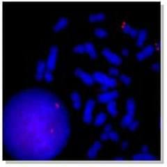 Human chromosome 1 subtelomere probes