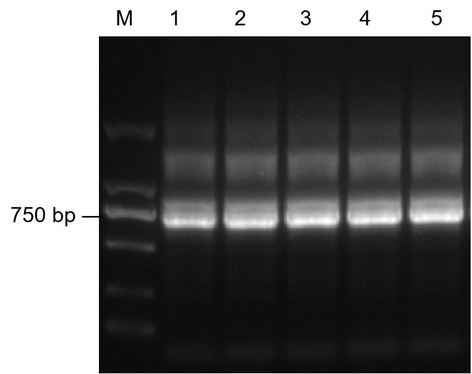 Fig 7. Preparation of mice scFv fragments. (Creative Biolabs Original)