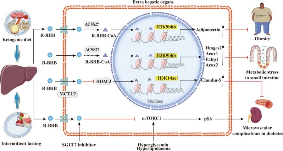 Role of Histone KBHB in metabolic diseases. (OA Literature)