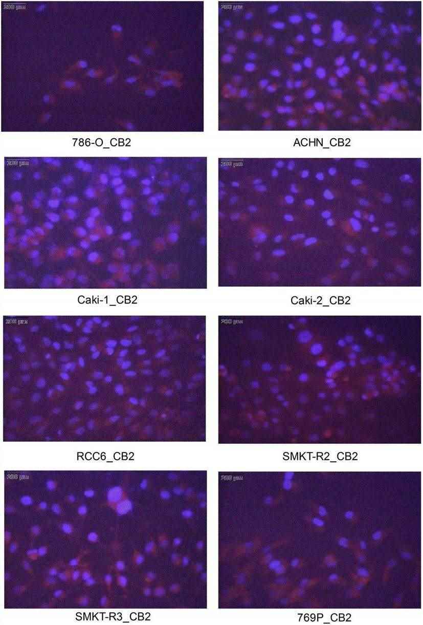Immunocytochemical (ICC) staining of cannabinoid receptors.