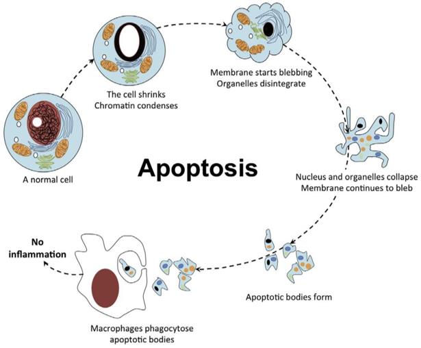 Cytology of apoptosis (Abou-Ghali, 2015)