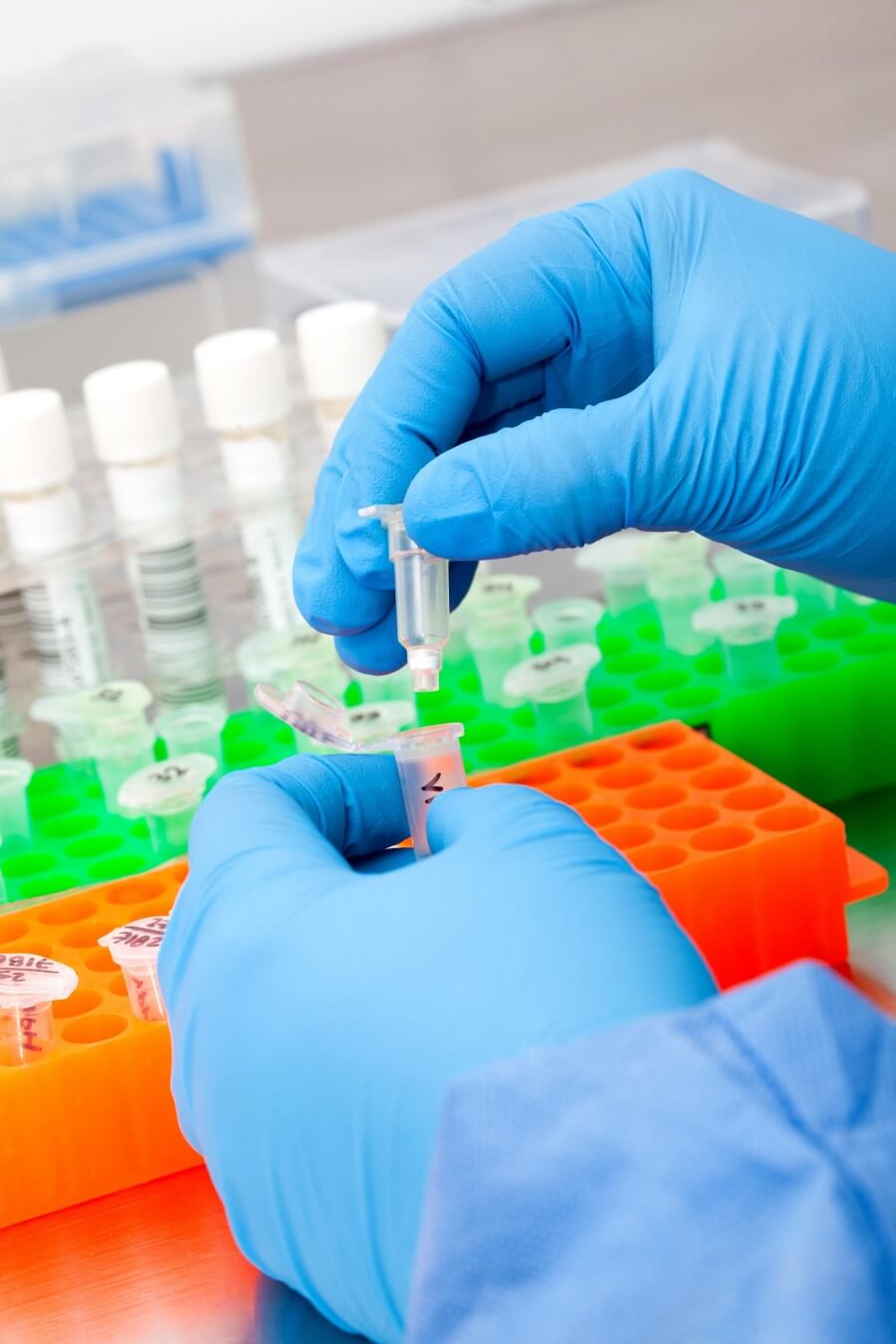 Fig.2 Lab assay. (Creative Biolabs Authorized)