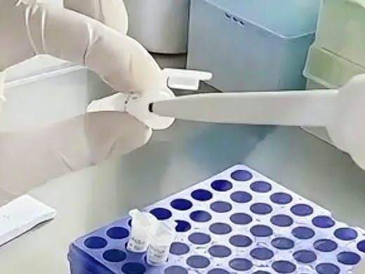 Fig.1 Experiment (Creative Biolabs AI)