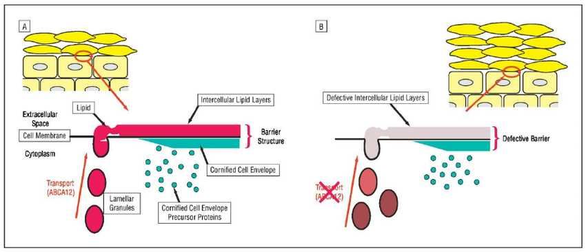 ABCA12 Membrane Protein Introduction