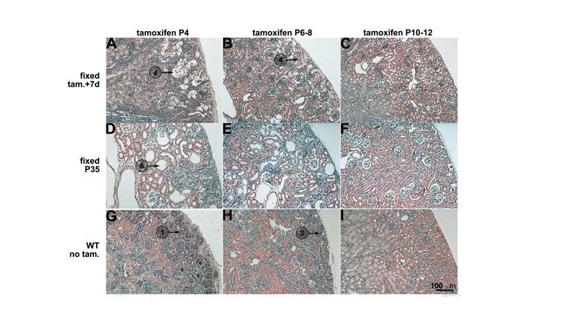 Effect of Aqp11 deletion on postnatal kidney development.