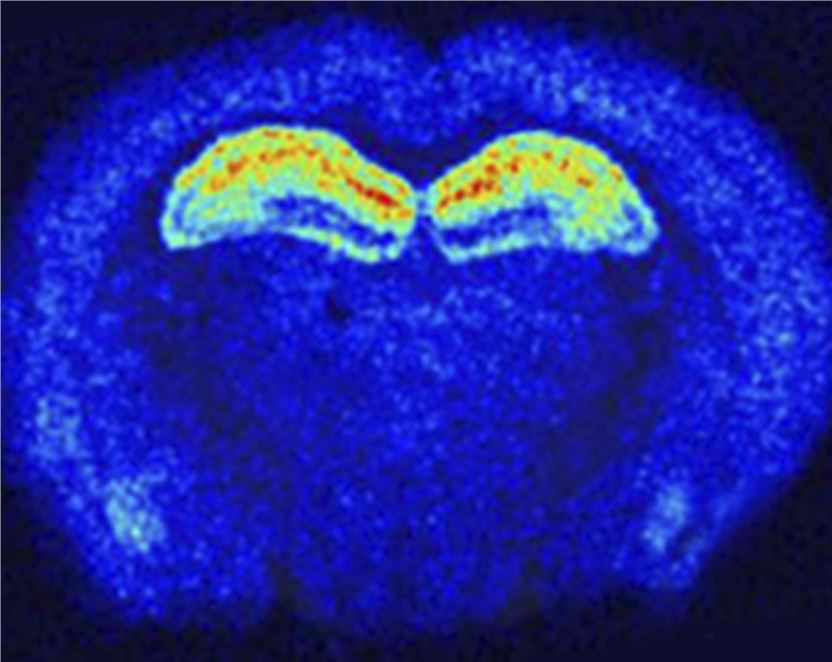 Expression pattern of CACNG8 gene in situ hybridization in mouse brain coronal sections (Gardinier, 2016)