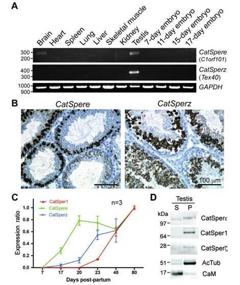 CATSPERE Membrane Protein Introduction