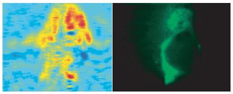 Figure 2. SPR microscopy images and immunofluorescence images of the same cell