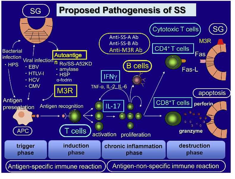 Proposed pathogenesis of SS. 