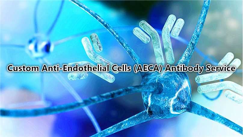 Custom Anti-Endothelial Cells (AECA) Antibody Service.