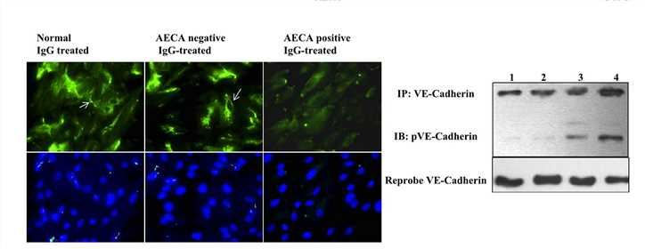 Immunocytochemical analysis of normal IgG and AECA-negative IgG-stimulated HKEC.
