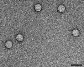 TEM micrograph of Enterovirus A71