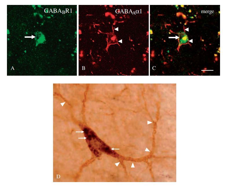 Colour confocal laser scanning images showing double-labeled neurons in the human striatum double-labeled for GABAB(1)(A) and GABAAα1(B) and the merged images (C).
