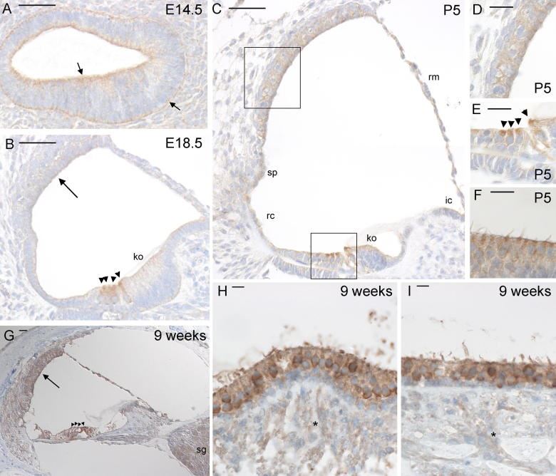 Immunohistochemistry for <em>Kcna10</em> expression in the mouse inner ear. 