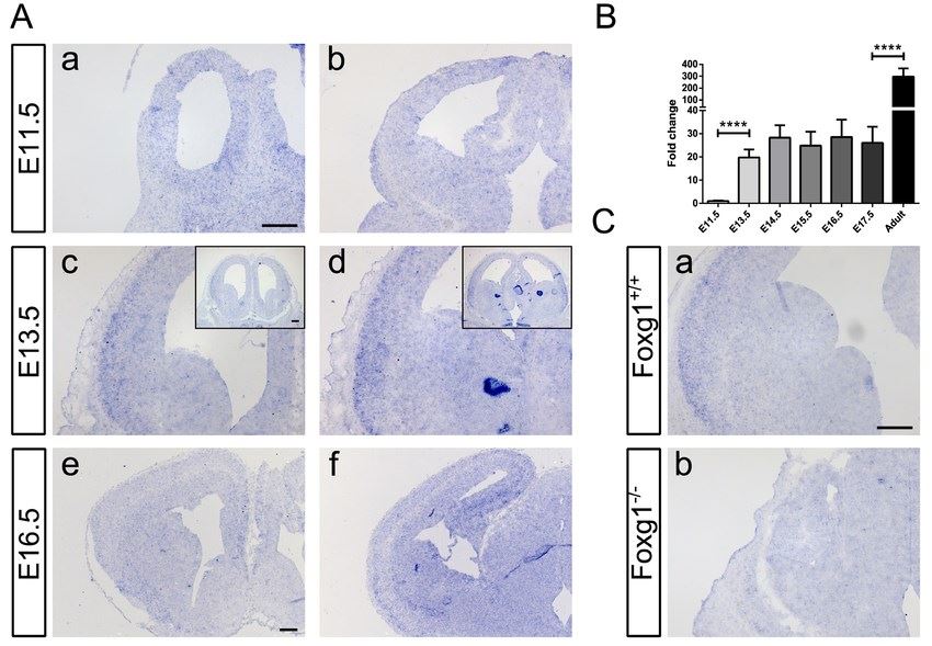 Characterization of spatial and temporal expression of Kcnh3 in the developing murine forebrain.