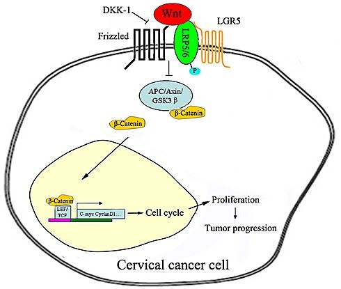 Proposed model of the LGR5-mediated promotion of cervical cancer growth <em>via</em> the Wnt/β-catenin  signaling pathway.