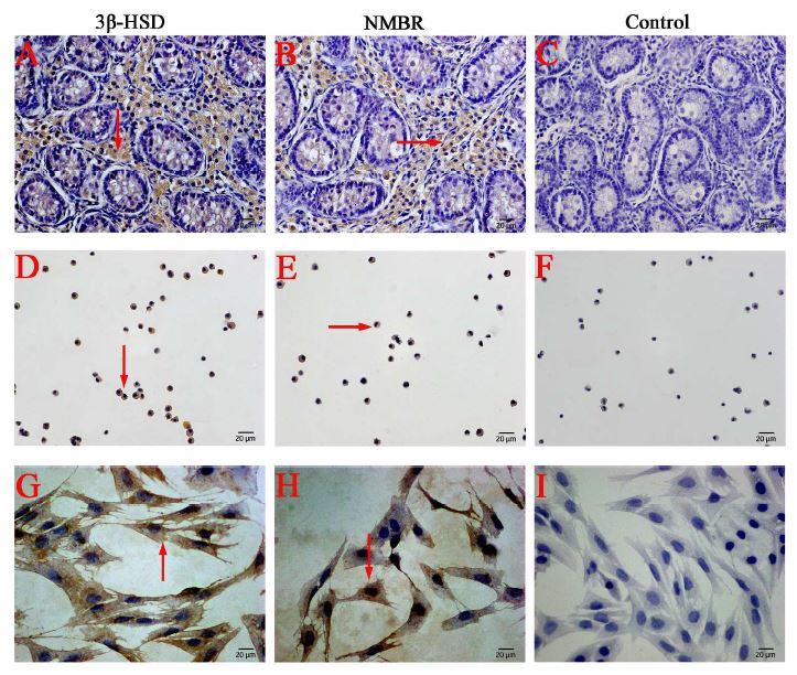 Distribution of NMBR in Leydig cells of the testes.