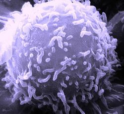 Phage Display Library Screening by Affinity Isolation of Antigen-Specific B Cells
