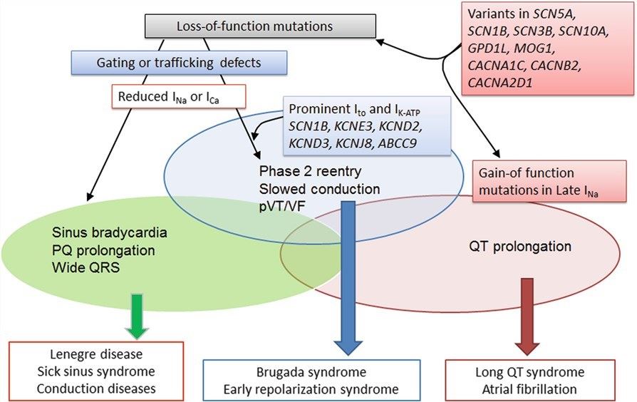 Schematic showing overlap between Brugada and other inherited cardiac arrhythmia syndromes resulting from genetic defects secondary to loss-of-function of sodium (INa) and/or calcium (ICa) channel current.