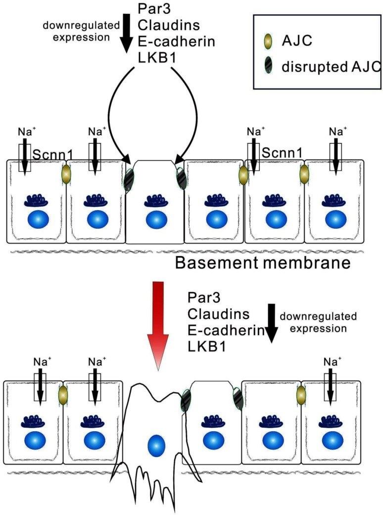 Epithelial apicobasal polarity suppresses the development of tumor to later stages. 