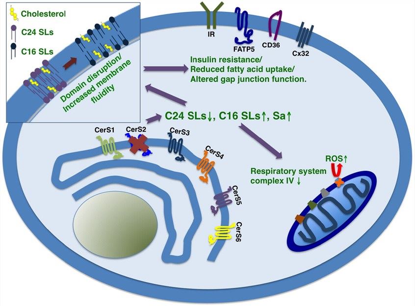 Signaling pathway of SLC27A5 in lipid metabolism