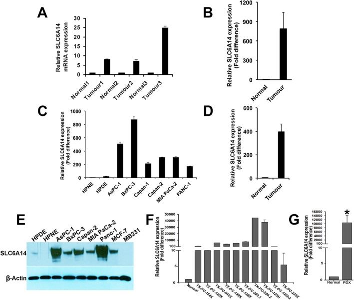 SLC6A14 Membrane Protein Introduction