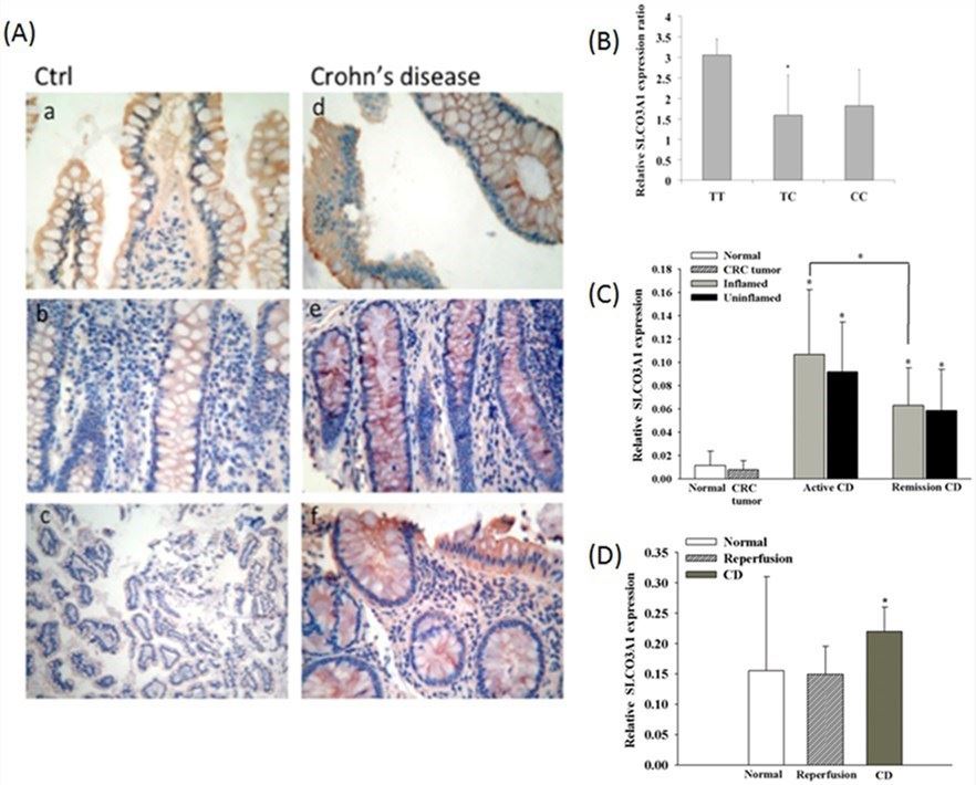 rs207959 T/C elevates SLCO3A1 mRNA and protein expression levels in colon and small intestine tissue of normal, non-CD diseases, and CD patients.