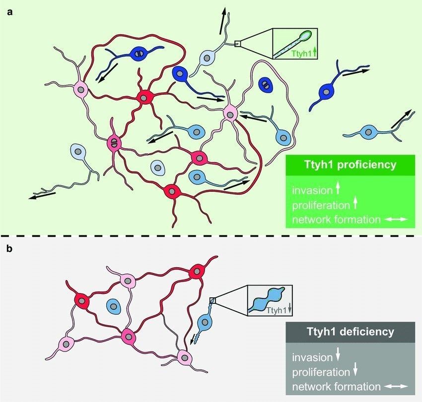 Schematic illustration of the role of TTYH1 for TM functions and brain tumor progression.