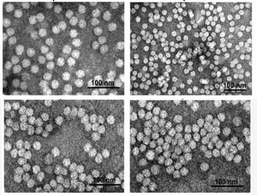 Representative pictures of virus-like particles (VLPs) under electron microscopy