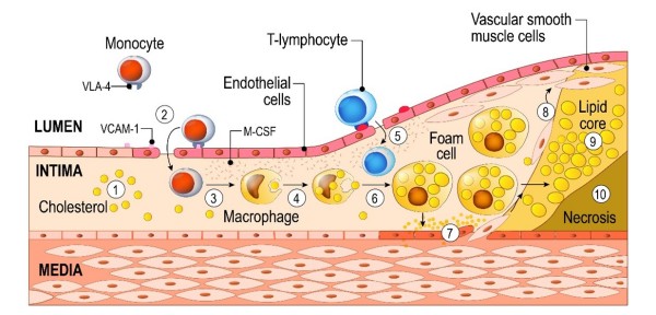 In Vivo Phage Library Screening Service for Atherosclerosis Targeting